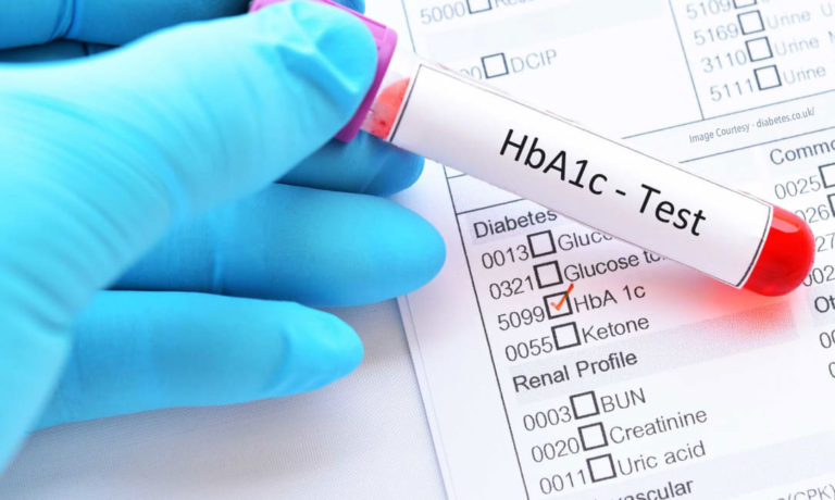 HbA1C