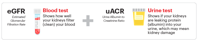 Што е uACR?
